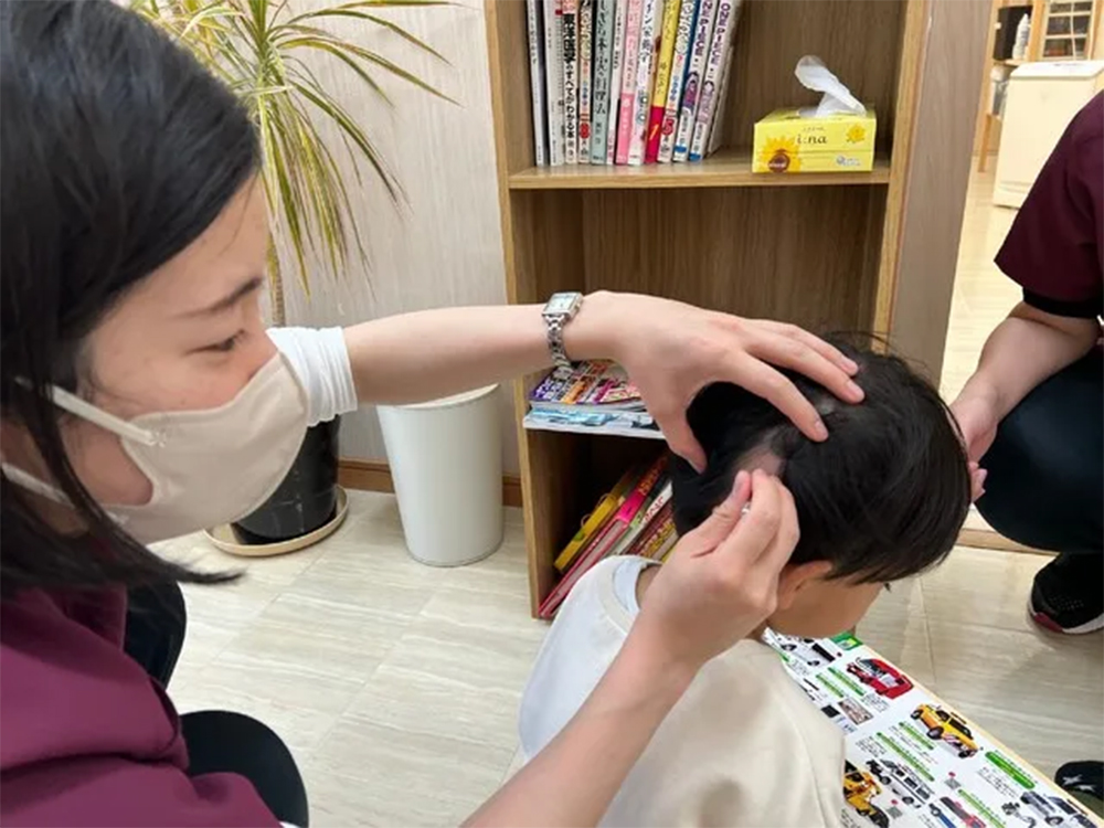 円形脱毛症の治療
