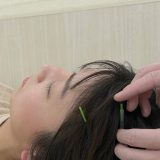 気になる髪の毛の悩み…薄毛・抜け毛対策できていますか？