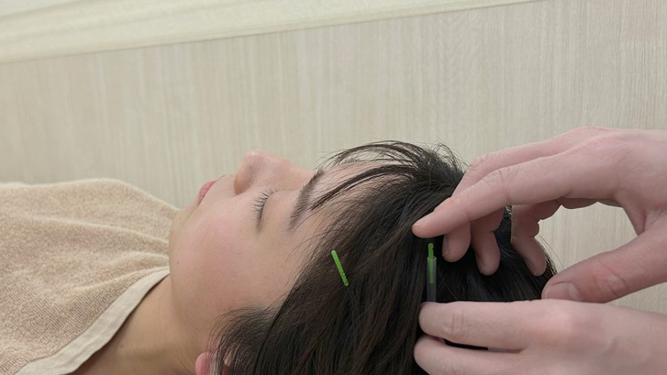気になる髪の毛の悩み…薄毛・抜け毛対策できていますか？