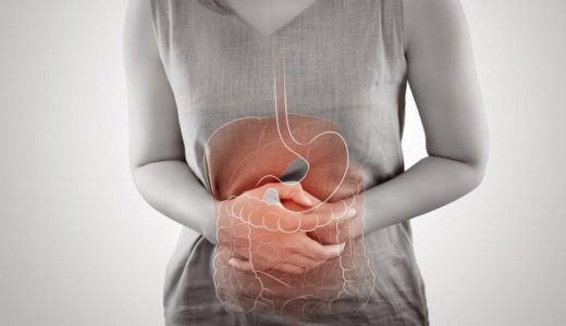 潰瘍性大腸炎でお悩みの女性へ