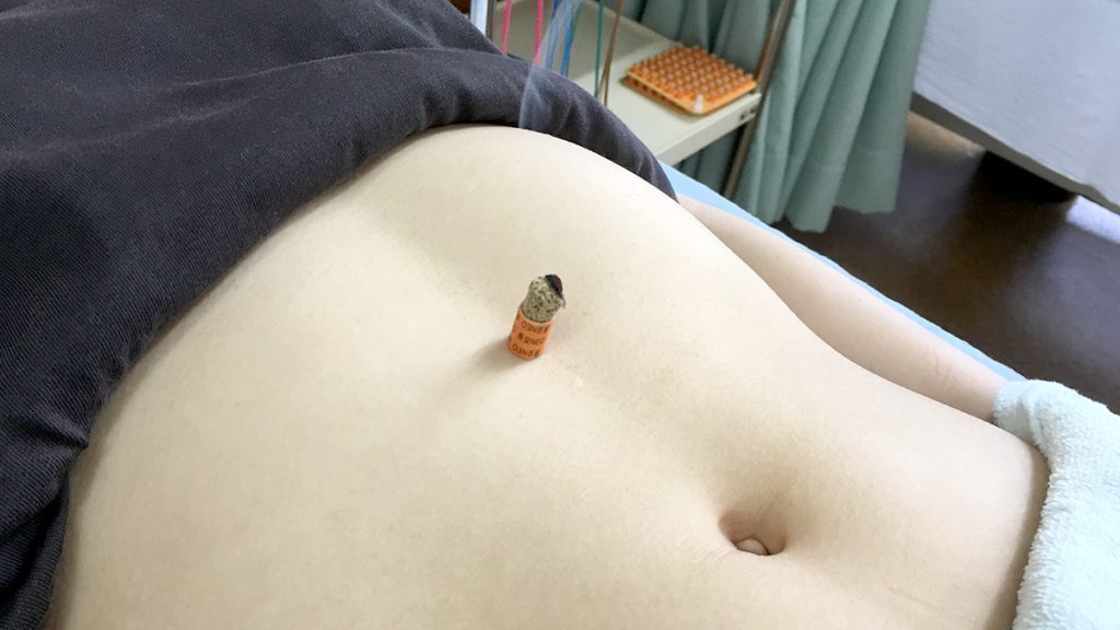 機能性ディスペプシア