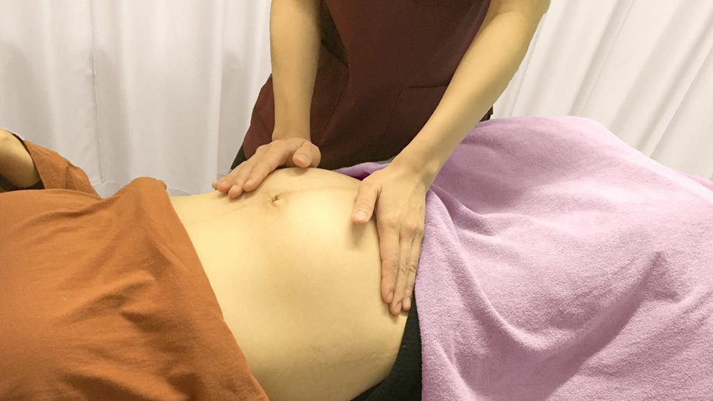 逆子体操しても治らない時の逆子治療