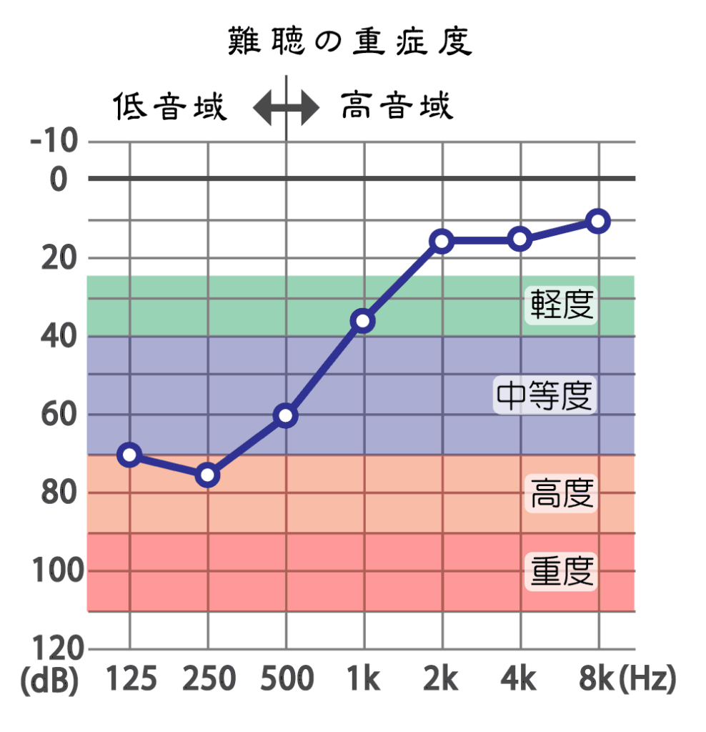 女性の難聴聴力検査