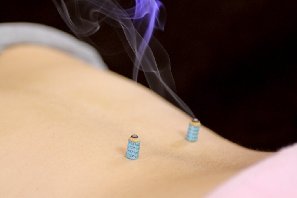 女性のコロナ後遺症外来