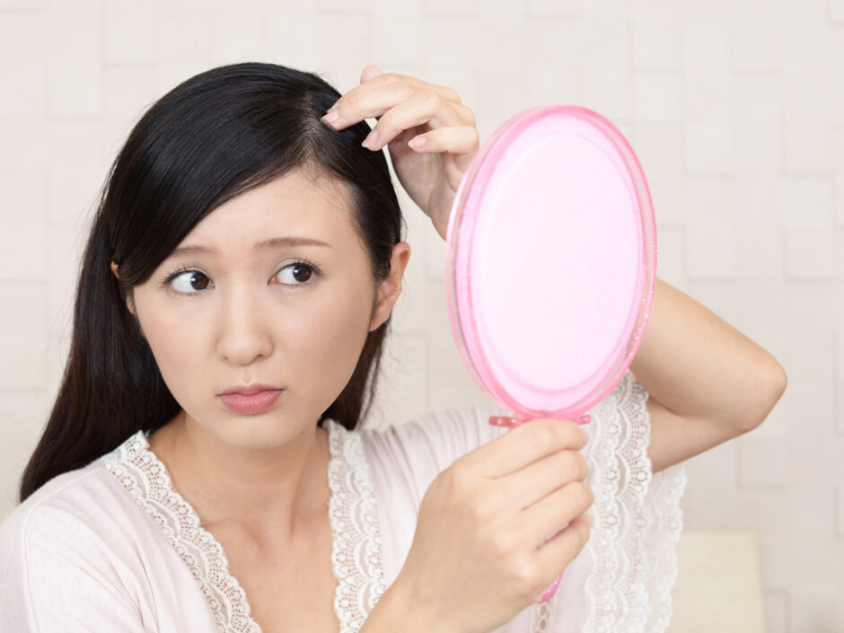 名古屋レディース薄毛外来