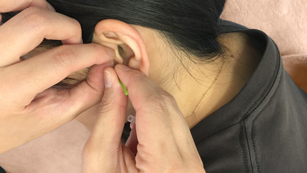 名古屋めまい治療