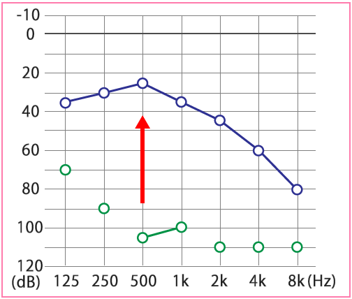 名古屋メニエール病外来