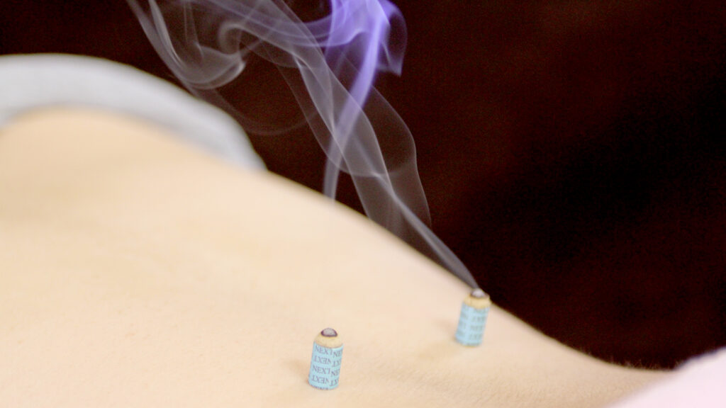 機能性ディスペプシアの治療